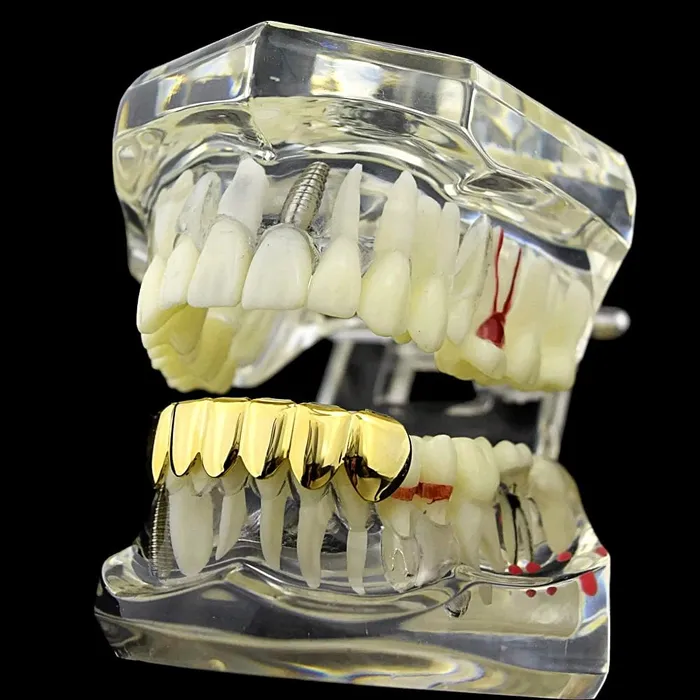 Bling Cartel Admin PreStyled Sets 14K Gold Plated Bottom Teeth Plain Grillz