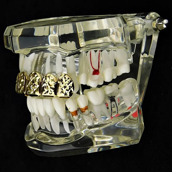 Earrings 14K Gold Plated DiamondCut Top Teeth Grillz Bling Cartel Admin