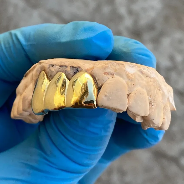 Gold Plated over 925 Sterling Silver Three Teeth Custom Grillz Bling Cartel Admin Rings