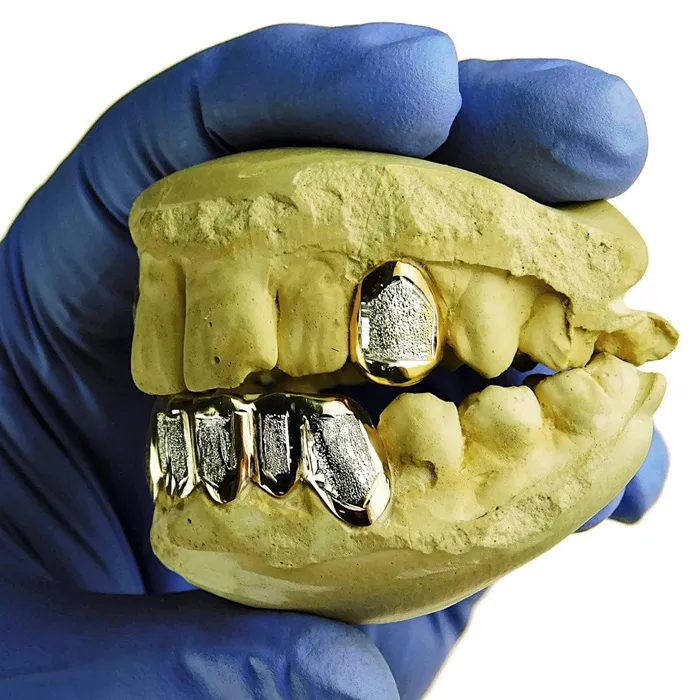 Real 14k Gold TwoTone Diamond Dust 26 Custom Grillz Bling Cartel Admin Rings