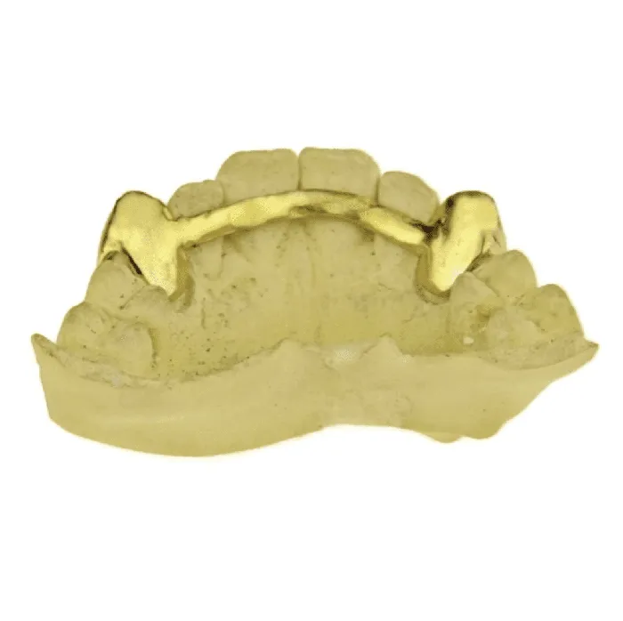 Real 14k Gold TwoTone Diamond Dust 26 Custom Grillz Bling Cartel Admin Rings