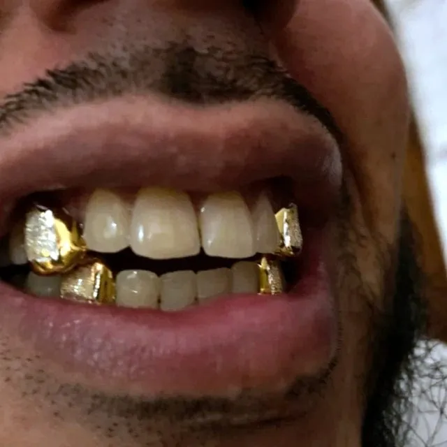Real 14k Gold TwoTone Diamond Dust 26 Custom Grillz Bling Cartel Admin Rings