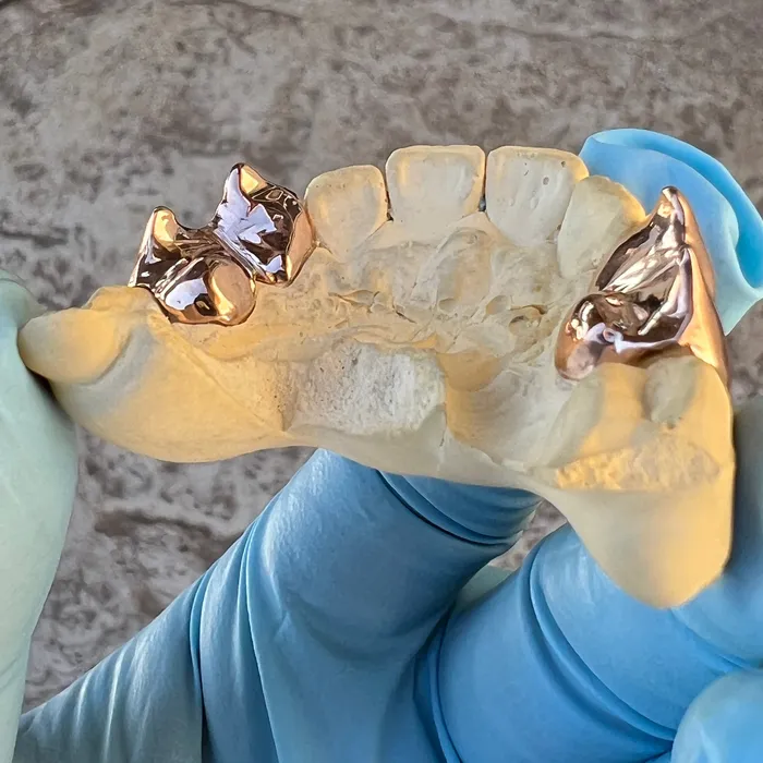 Rings Bling Cartel Admin Rose Gold Plated over 925 Silver Custom Double Teeth Vampire Fangs Grillz