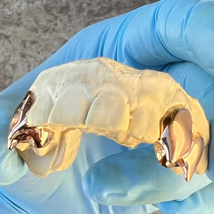 Rings Bling Cartel Admin Rose Gold Plated over 925 Silver Custom Double Teeth Vampire Fangs Grillz