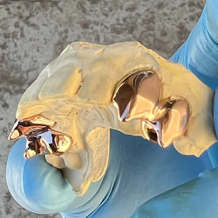 Rings Bling Cartel Admin Rose Gold Plated over 925 Silver Custom Double Teeth Vampire Fangs Grillz